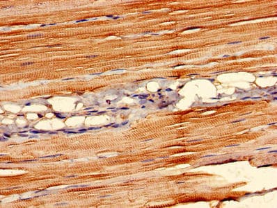 Polyclonal Rabbit anti-Human FAM168B Antibody (IHC)