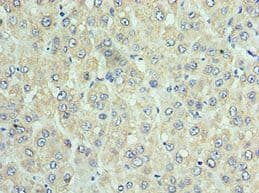 DNAJC2 / ZRF1 Antibody (aa1-140)