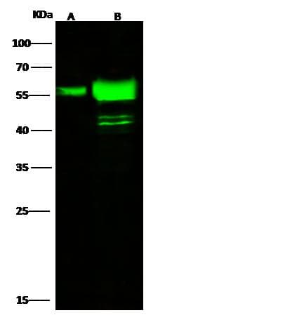 KRT7 / CK7 / Cytokeratin 7 Antibody (Preservative Free)