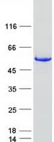 Human ACCS / ACS Protein (Recombinant Myc-DDK (Flag))