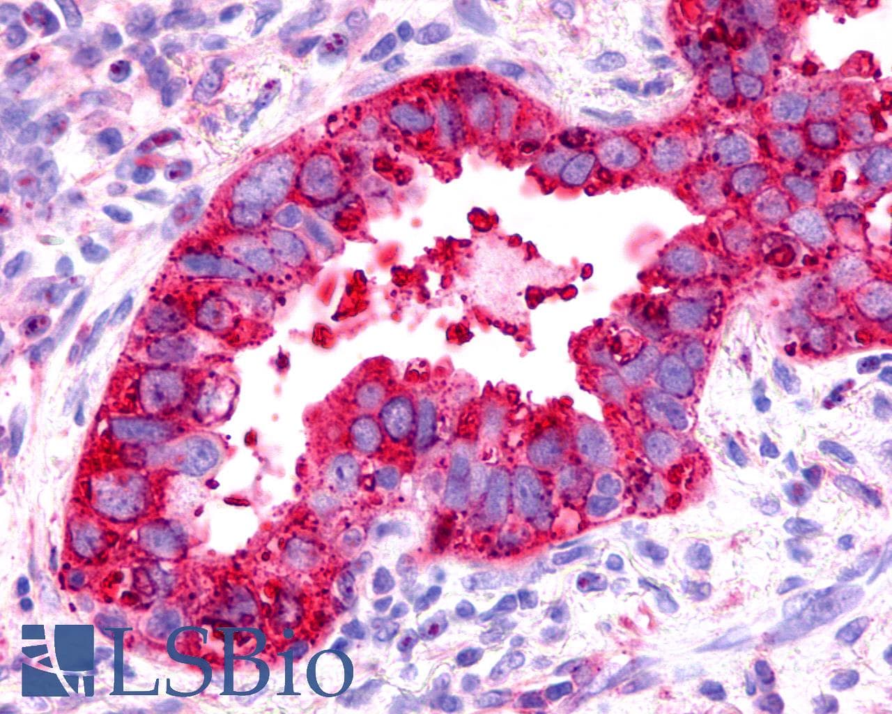 PathPlus™ TPRA1 / GPR175 Antibody (Cytoplasmic Domain)