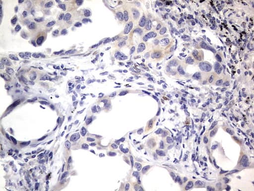 PRX-1 / PRRX1 Antibody (clone OTI1E10)