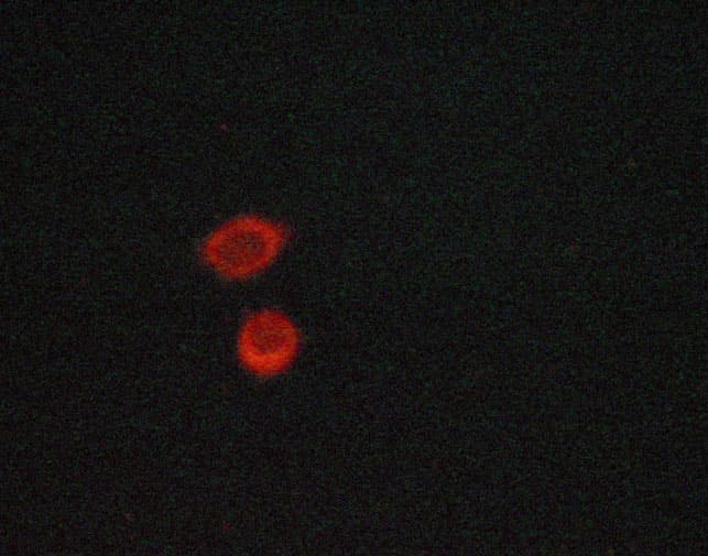 Polyclonal Rabbit anti-Human NFKBIA / IKB Alpha / IKBA Antibody (phospho-Ser32,phospho-Ser36, IHC, IF, WB)