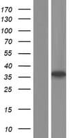 Rhodanese / TST Protein (Over-Expression Lysate Myc-DDK (Flag))