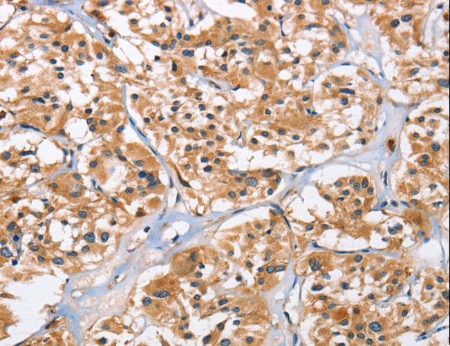 4E-BP2 / EIF4EBP2 Antibody