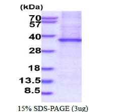 Human SFRP2 Protein (Recombinant His)
