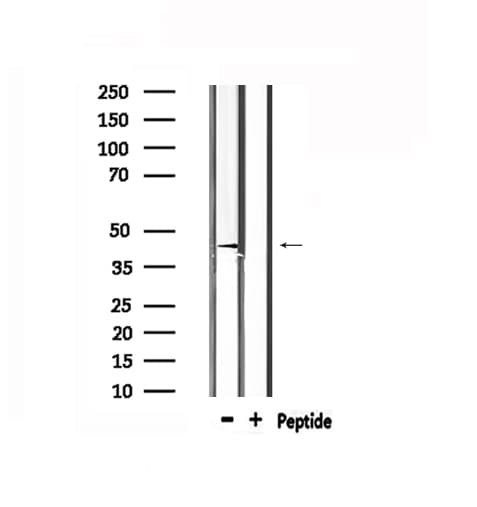 RARA / RAR Alpha Antibody