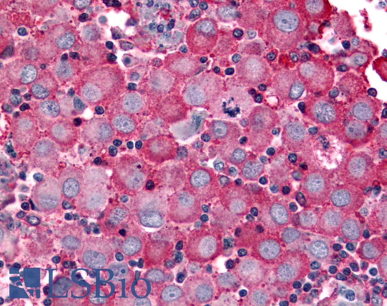 PathPlus™ Polyclonal Rabbit anti-Human ADGRB2 / BAI2 Antibody (C-Terminus, IHC)