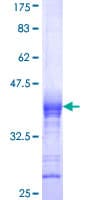 Human CACNB2 Protein (Recombinant GST, N-terminus)