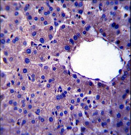 Polyclonal Rabbit anti-Human LIN52 Antibody (aa44-73, IHC, WB)