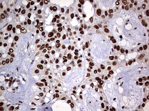 HNRPM / HNRNPM Antibody (aa1-261, clone OTI1E12)