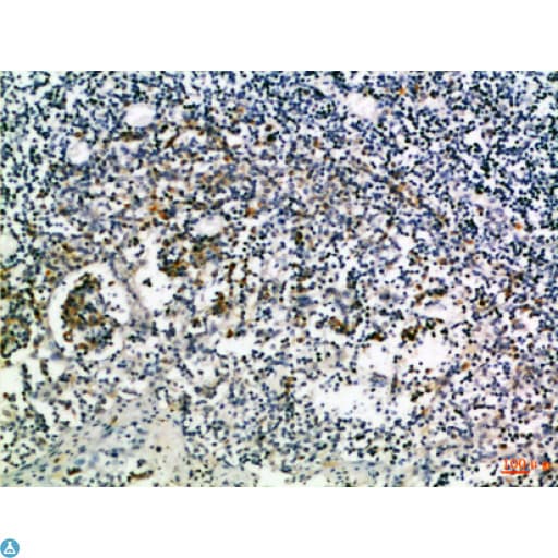CD274 / B7-H1 / PD-L1 Antibody