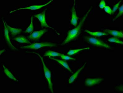 Polyclonal Rabbit anti-Human LRRC45 Antibody (IHC, IF)
