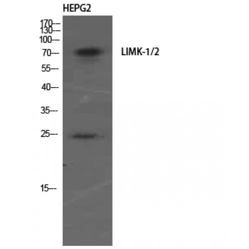 LIMK1 + LIMK2 Antibody (450-530 aa)