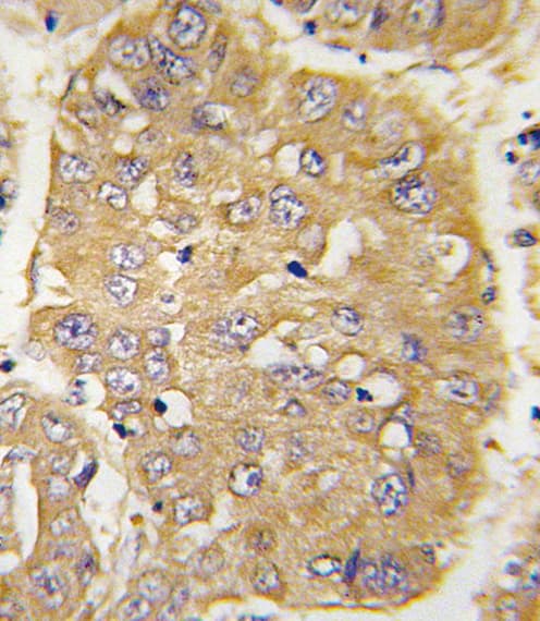 IGFBP3 Antibody (aa163-193)
