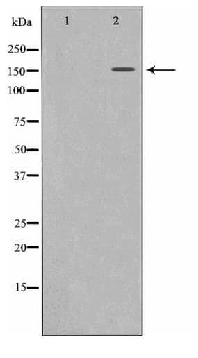 Polyclonal Rabbit anti-Human MRC2 / Endo180 Antibody (IHC, IF, WB)
