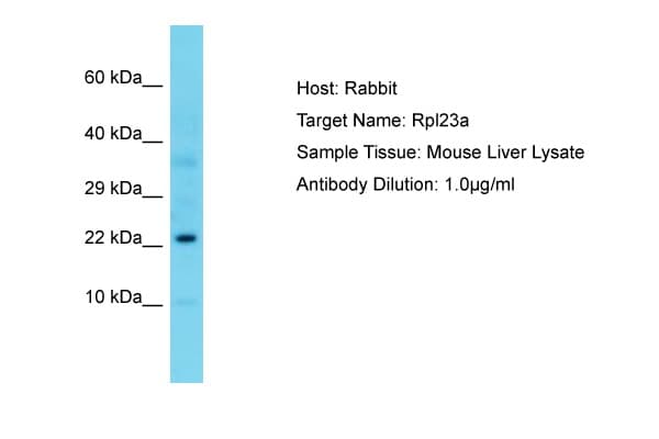 RPL23A Antibody (C-Terminus)