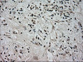 NTRK3 / TRKC Antibody (clone OTI24B3)