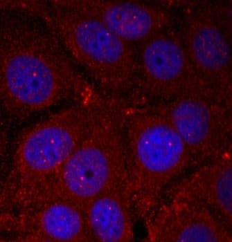 SNCA / Alpha-Synuclein Antibody (phospho-Tyr136)