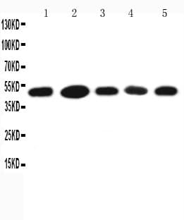 ST13 Antibody (aa1-19)