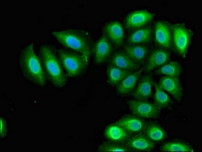 Polyclonal Rabbit anti-Human RBM38 Antibody (IHC, IF)