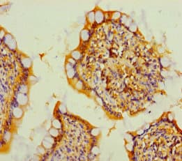 Polyclonal Rabbit anti-Human TMEM207 Antibody