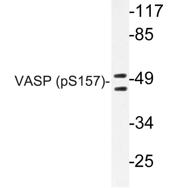 VASP Antibody (phospho-Ser157)
