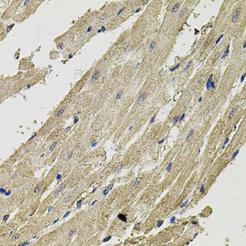 Polyclonal Rabbit anti-Human SMN2 Antibody (IHC, IF, WB)