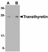 IHC-plus™ TTR / Transthyretin Antibody