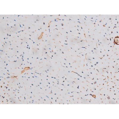 STAT3 Antibody (phospho-Ser727)
