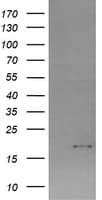CTAG1B / NY-ESO-1 Antibody (clone OTI5E1)