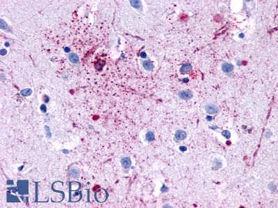 PathPlus™ GPR139 Antibody (Transmembrane Domain)