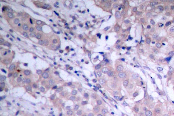 AKT1 + AKT2 + AKT3 Antibody (Pro467)