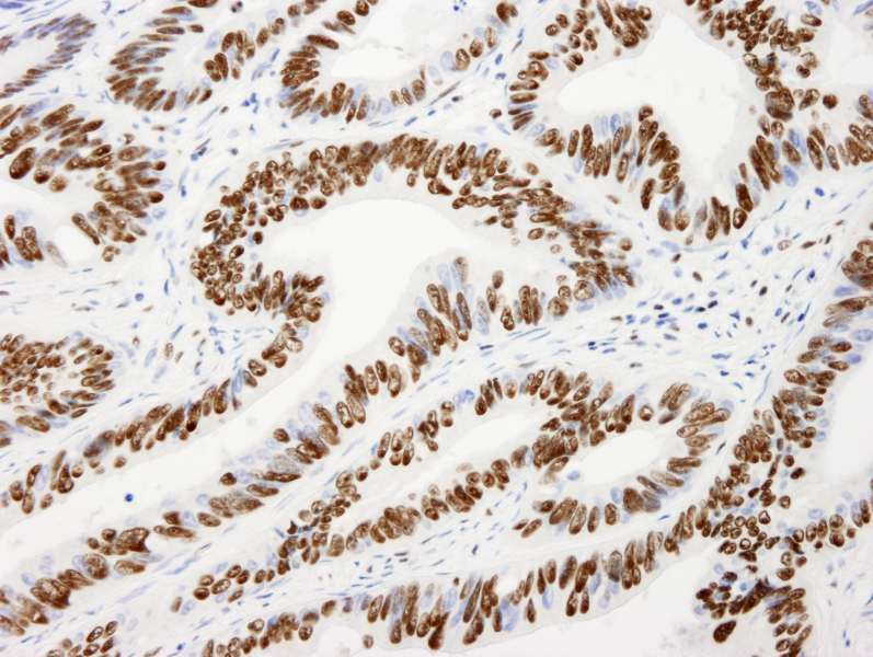 AKAP8L Antibody (aa596-646)
