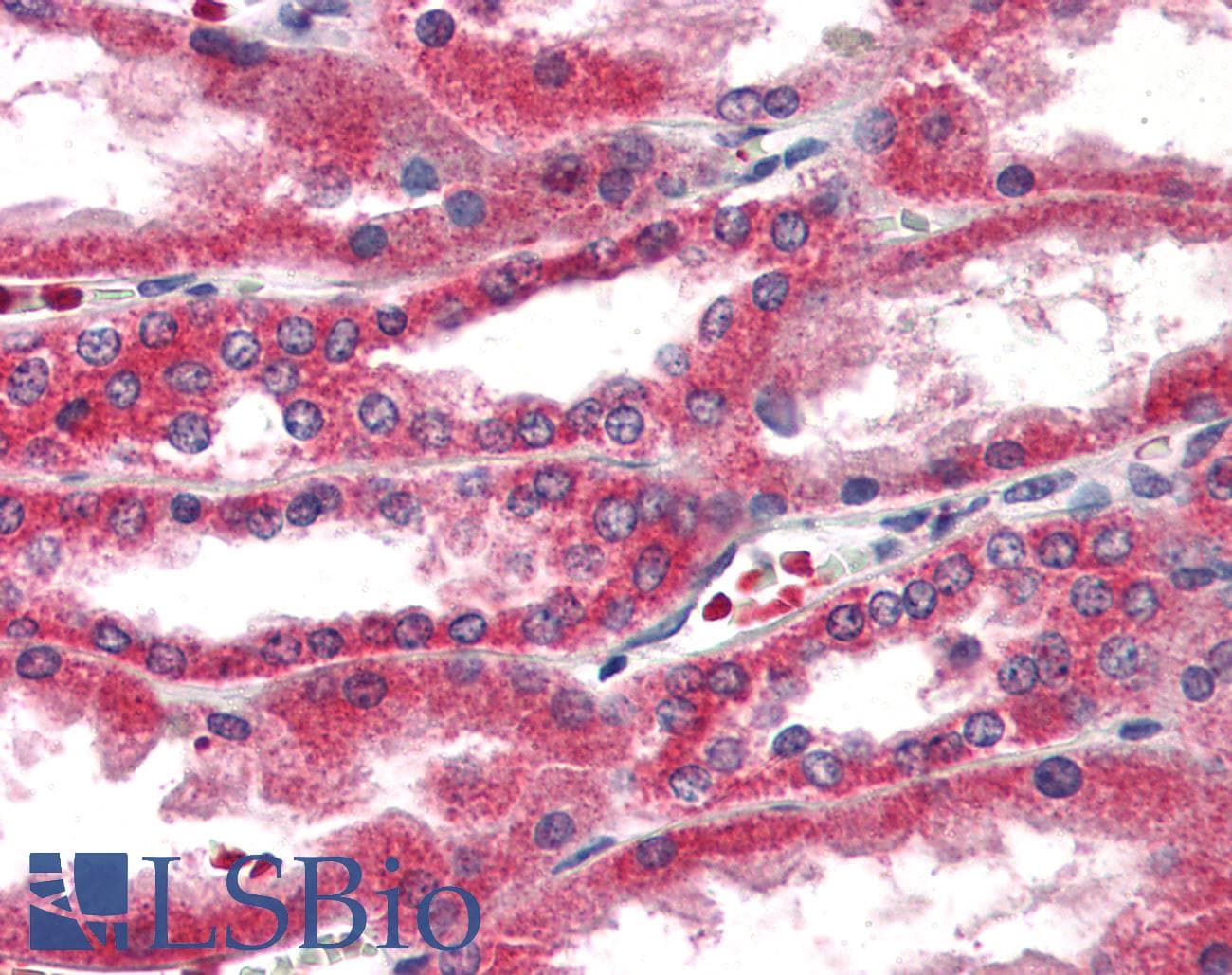 IHC-plus™ Polyclonal Rabbit anti-Human ARTS1 / ERAP1 Antibody (C-Terminus)