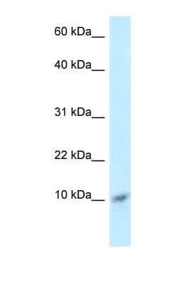 Polyclonal Rabbit anti-Human S100A8 / MRP8 Antibody (C-Terminus, WB)