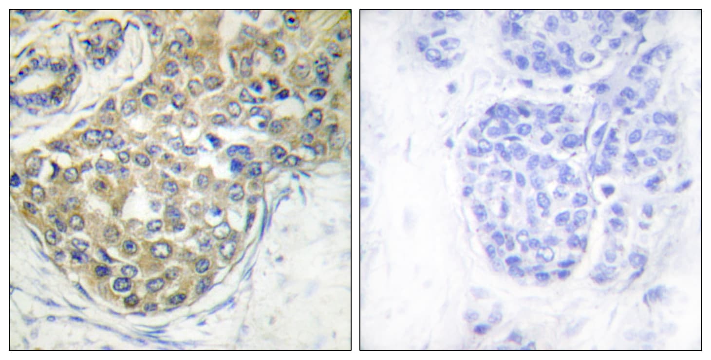 Polyclonal Rabbit anti-Human TNK2 / ACK1 Antibody (phospho-Tyr284, IHC, IF, WB)