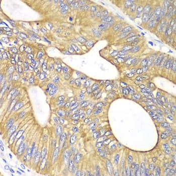 VEGFB Antibody
