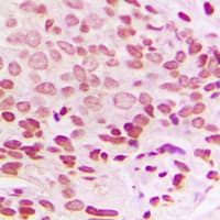 H1F0 Antibody (Internal)