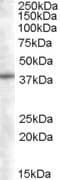 IHC-plus™ SNX16 Antibody (aa2-14)