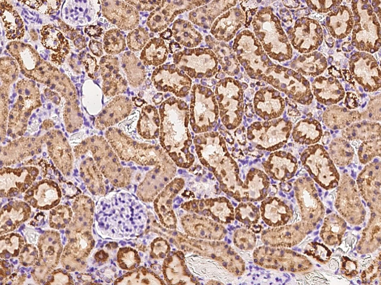 FH / Fumarase / MCL Antibody