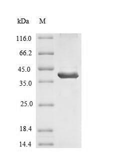 Human SLC1A1 / EAAT3 Protein (Recombinant GST, N-terminus)