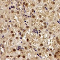 Polyclonal Rabbit anti-Human EGLN1 / PHD2 Antibody (IHC, IF, WB)