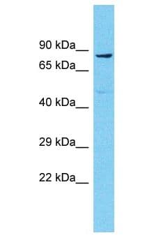 Polyclonal Rabbit anti-Human NBPF6 Antibody (aa182-231, WB)