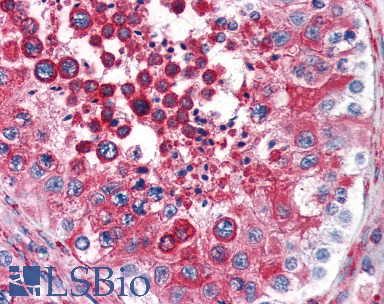 IHC-plus™ RTN4 / Nogo Antibody