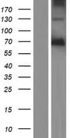 PODN Protein (Over-Expression Lysate Myc-DDK (Flag))