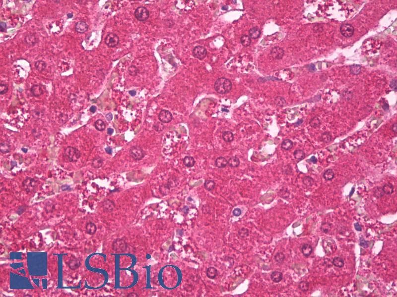 IHC-plus™ GLUL / Glutamine Synthetase Antibody