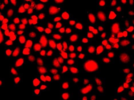 IFRD1 / TIS7 Antibody