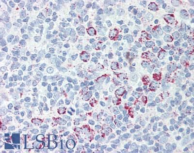 IHC-plus™ Polyclonal Rabbit anti-Human MCTS1 Antibody (IHC, WB)