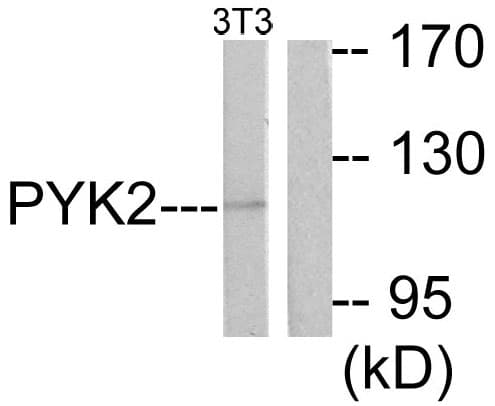 Polyclonal Rabbit anti-Human PTK2B / PYK2 Antibody (aa847-896, IHC, WB)